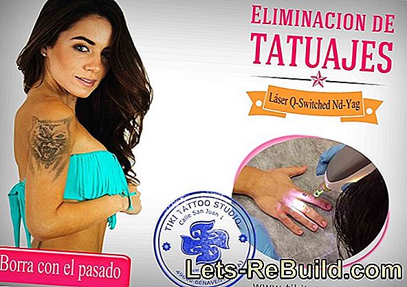 Eliminación de óxido: estos remedios caseros están ahí